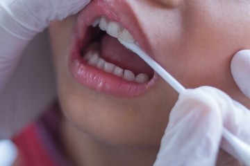 شیوع بالای انگل‌های دهانی در بیماران دیابتی