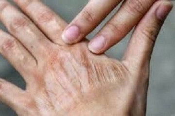 تأثیر خاموش آلودگی هوا بر سلامت و پیری پوست