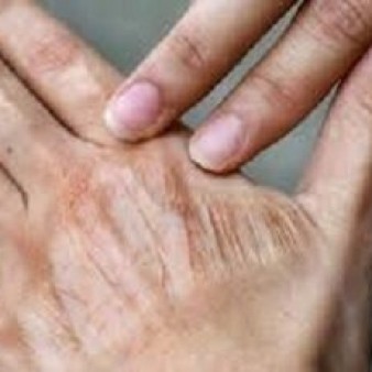 تأثیر خاموش آلودگی هوا بر سلامت و پیری پوست